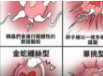 UpBKP.png